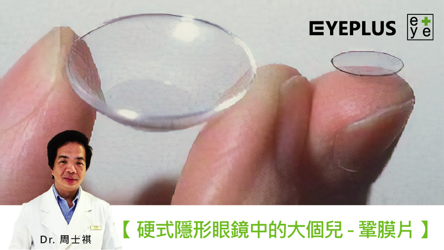 周醫師講堂 大家知道硬式隱形眼鏡有分大小嗎 Eyeplus 聚英視光眼科診所 Facebook
