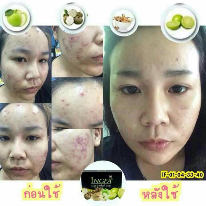 💦เผยเคล็ดลับ หน้าสด แบบ ใสกิ๊ง... - อิงฟ้า by Mapring | Facebook