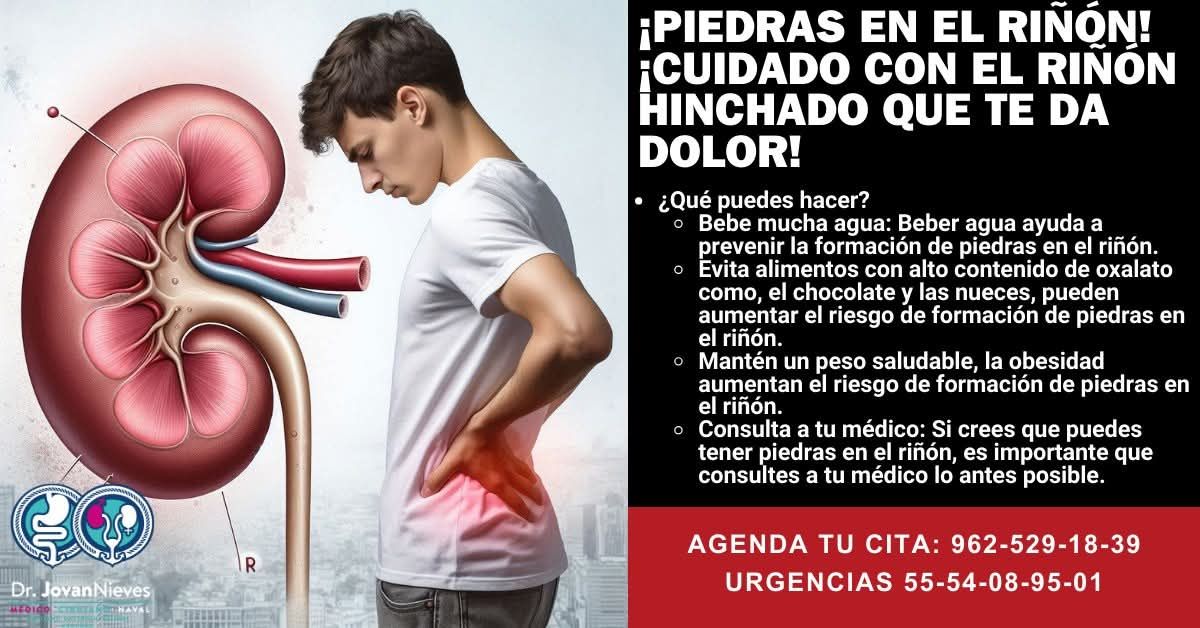 Jovan - ¿Dolor en la espalda o el abdomen y tu riñón se hincha ...