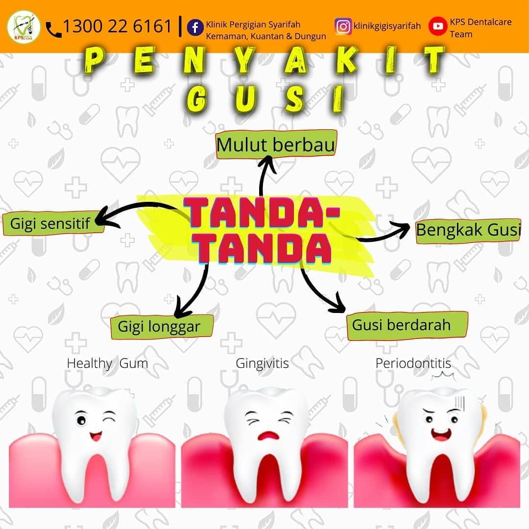 Klinik Pergigian Syarifah Indera Mahkota 8 Sila Ke Klinik Gigi Berdekatan Anda Dengan Segera Sekiranya Mempunyai Tanda Tanda Penyakit Gusi Seperti Di Bawah Khidmat Pelanggan Www Wasap My 60198834161 Ps Pergigiansyarifah Drsyadrgigi