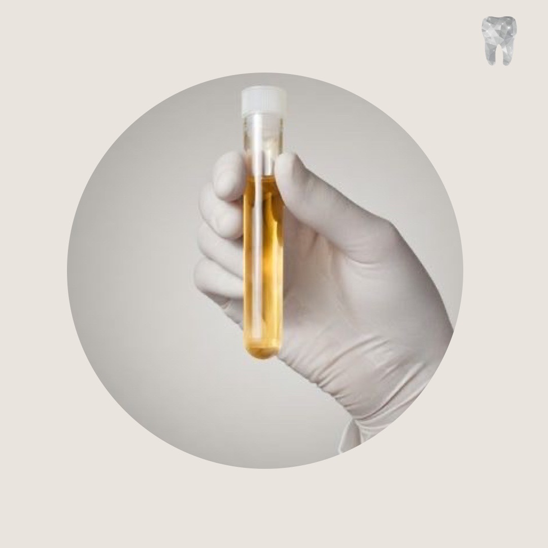 Dental Factory - PRP ♥️ Las principales ventajas del tratamiento es ...