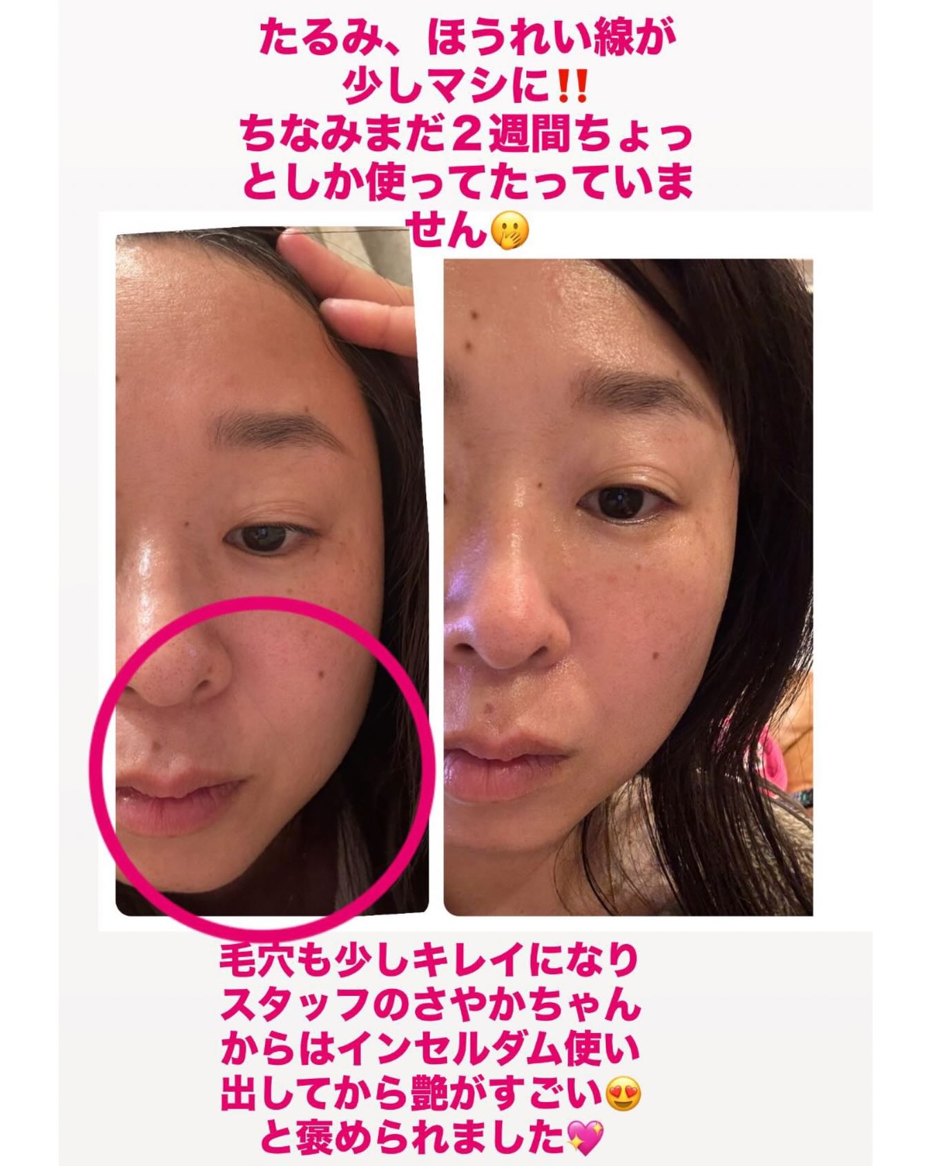 LUANA TOTAL BEAUTY【フォト美肌脱毛＋Skin】 | Fujisawa-shi Kanagawa