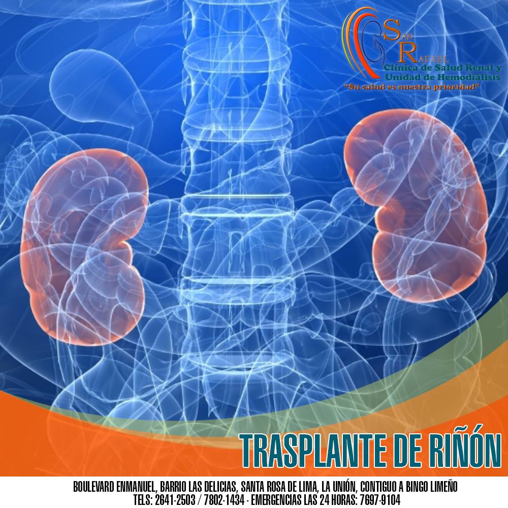 El transplante de riñón es una cirugía para colocar un riñón sano en ...
