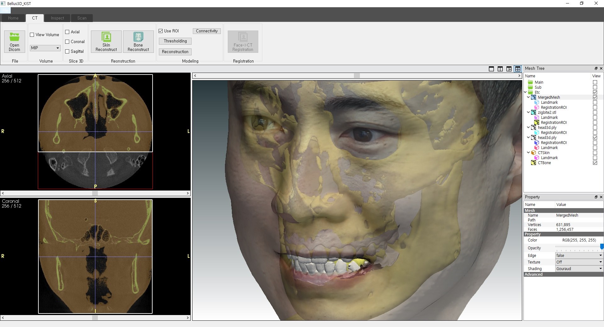 3Dme - Bellus3D 응용 소프트웨어를 소개합니다. -... - 3Dme by Imagoworks | Facebook