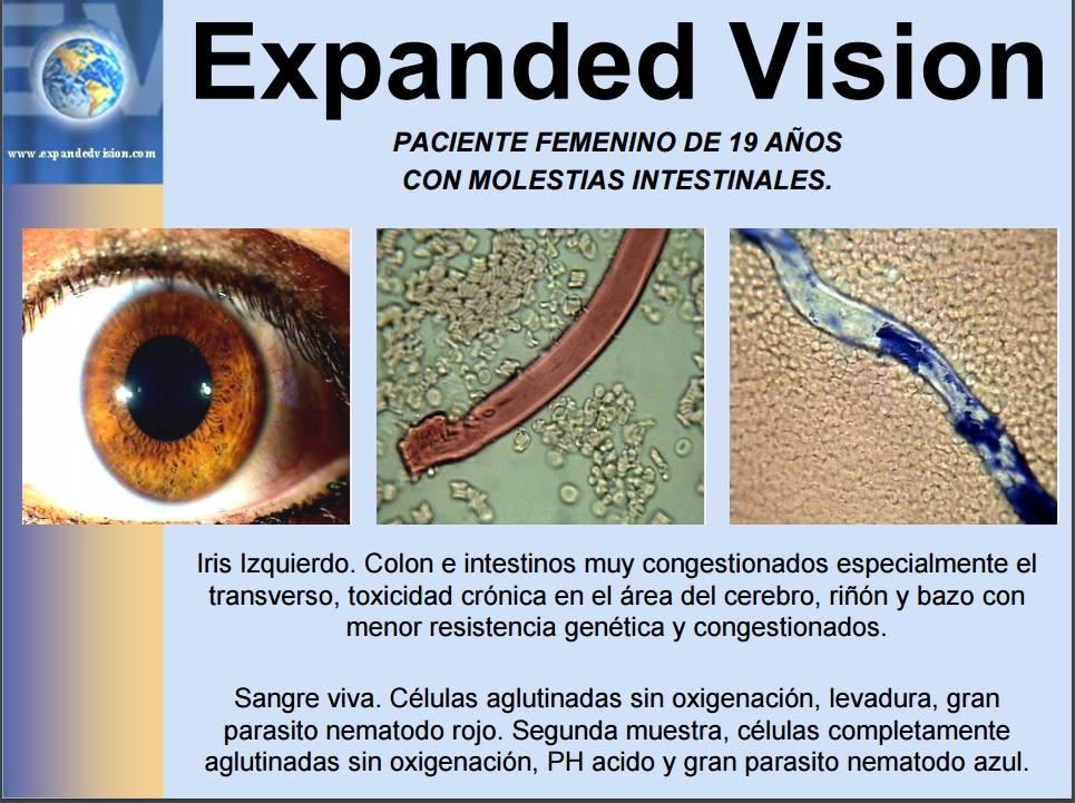 Expanded Vision Group Corp Estados Unidos de Norte America | Riverside CA