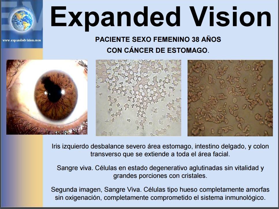 Expanded Vision Group Corp Estados Unidos de Norte America | Riverside CA