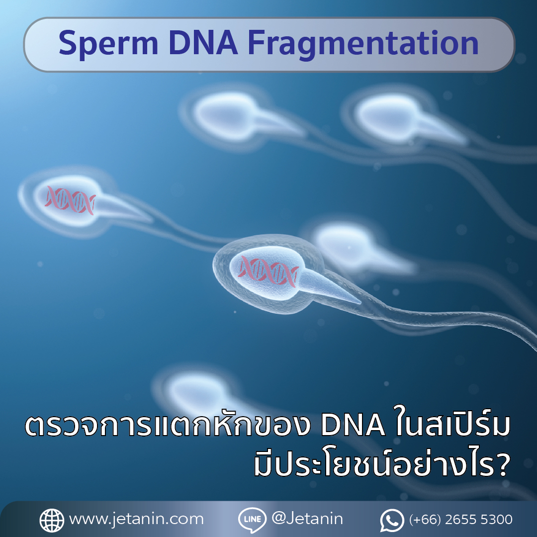 🤷‍♂️การตรวจ Sperm DNA Fragmentation คือ... - Jetanin Hospital