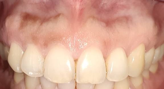 Dr. Arjun Hari Rijal, Periodontist and Oral Implantologist | Kathmandu