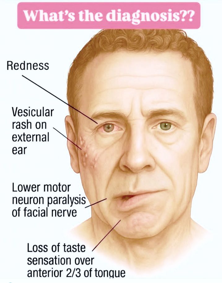 What's the diagnosis ? | Facebook