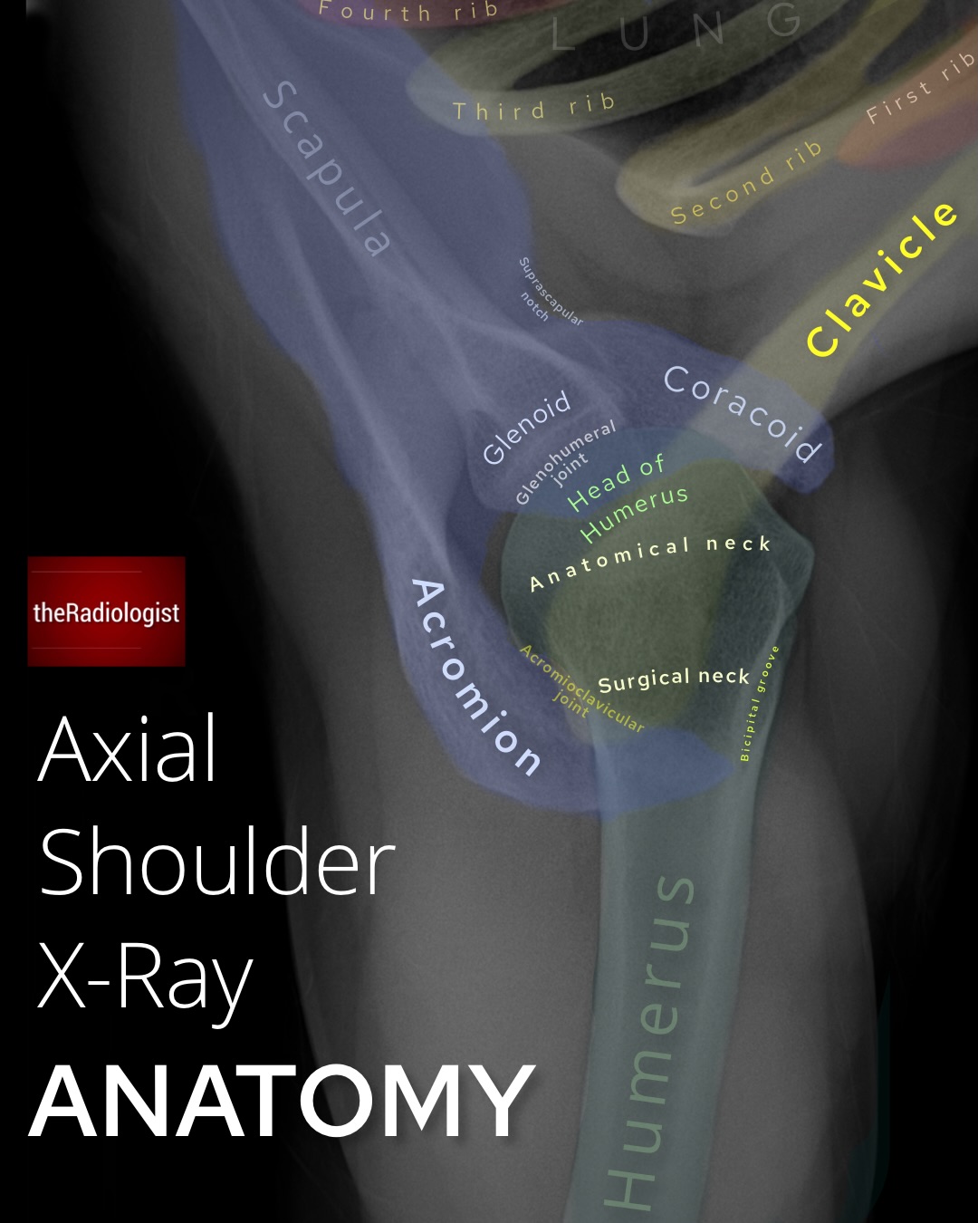 The Radiologist - CT HEAD ANATOMY⁣ Axial slice of a non contrast CT ...