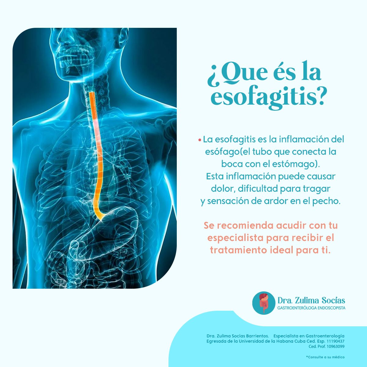 Dra - La esofagitis es la inflamación del esófago. Esta inflamación ...