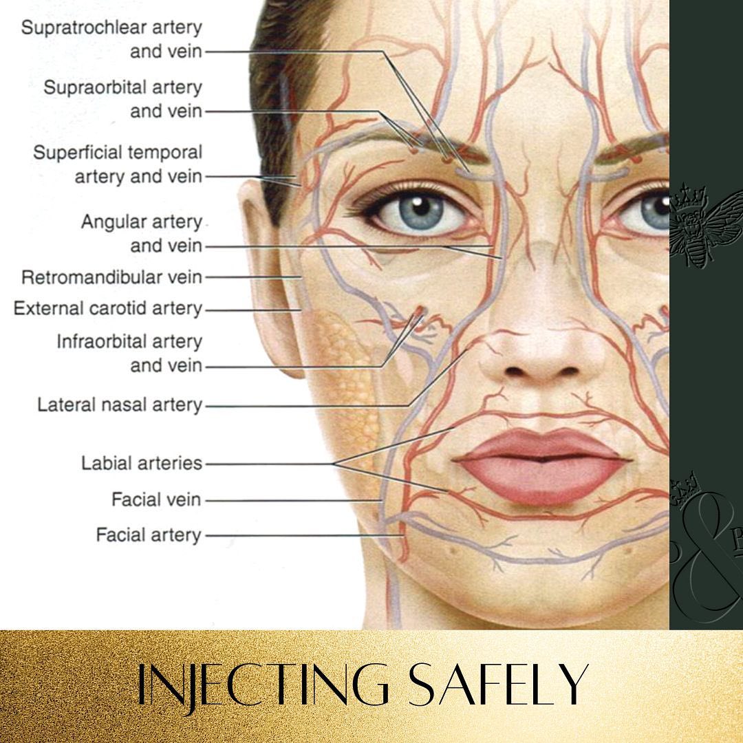 Bad - 💉⚠️Injecting safely ⚠️💉 Every single non-surgical injection ...