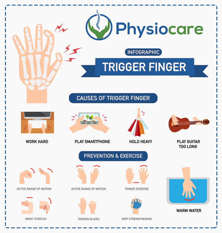 Physiocare - Trigger Finger causes and prevention... | Facebook