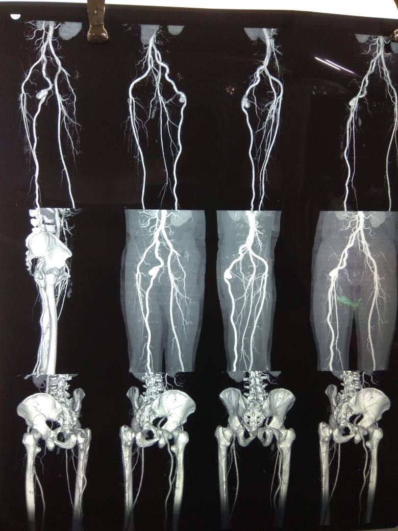 Vascular Surgeon Dr Nitin Pathak | Pune