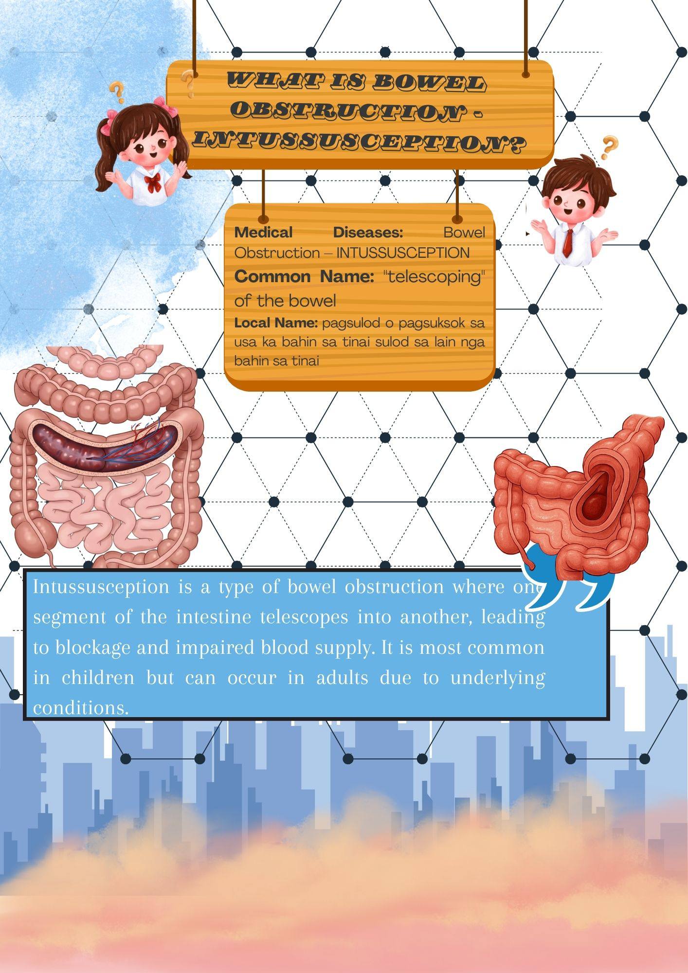 “Intussusception: when one... - Grace Joy Batisting Gamutan | Facebook
