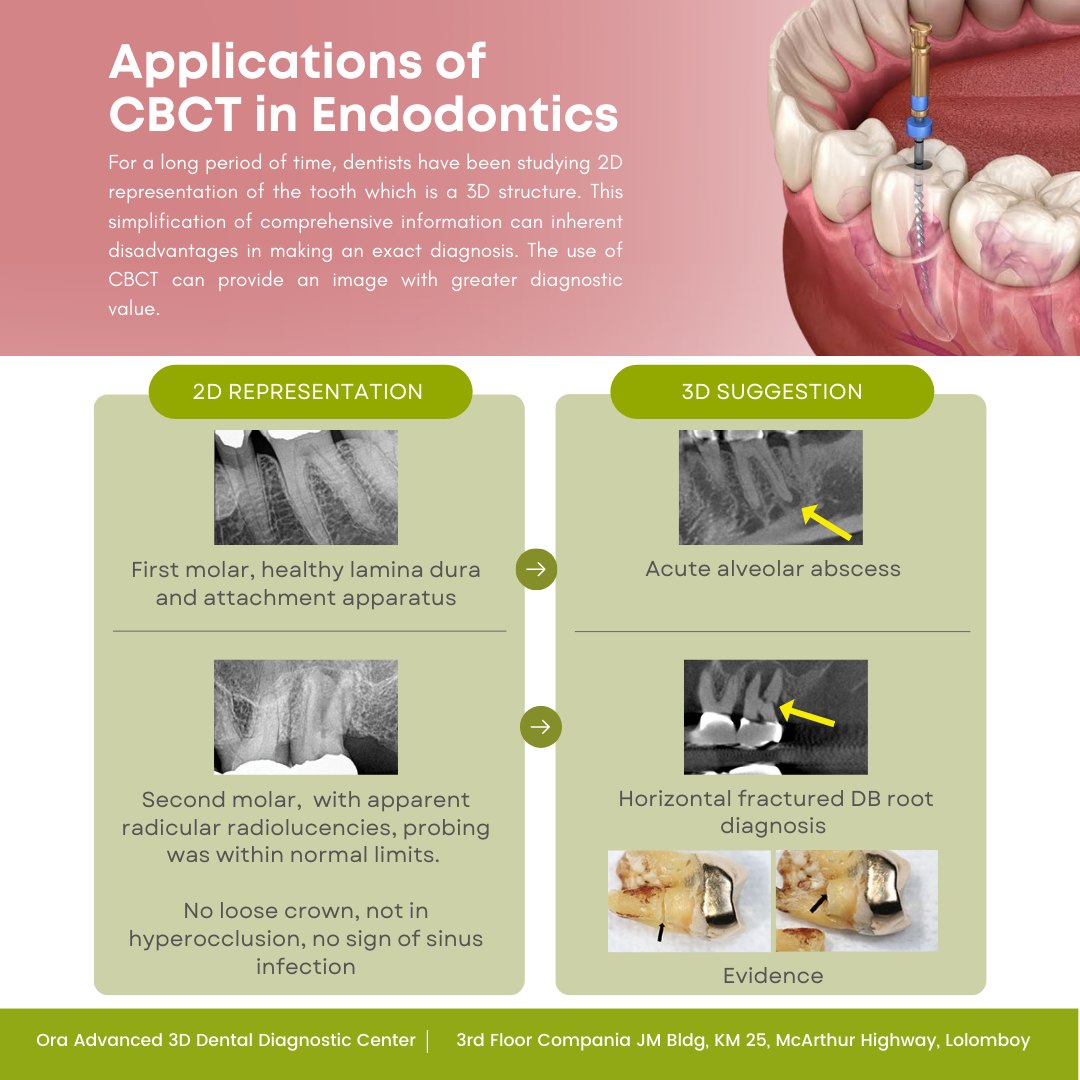 2D vs 3D:... - Ora Advanced 3D Dental Diagnostic Center
