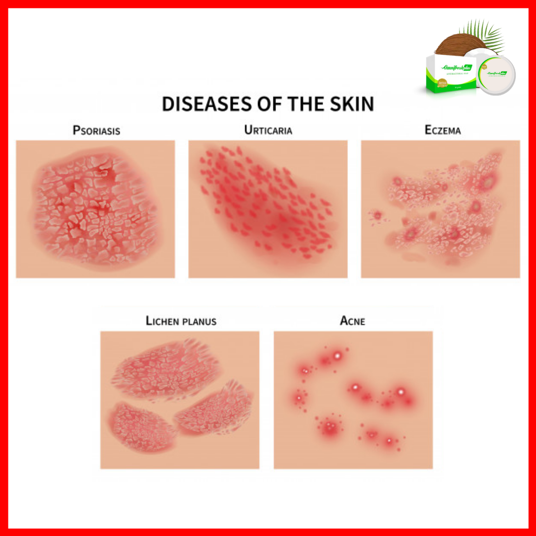 Omnifresh Plus: Healthy Skin - Ang balat ay ang pinaka-malaking bahagi ...