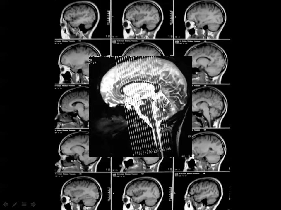 Easy Radiology 2017