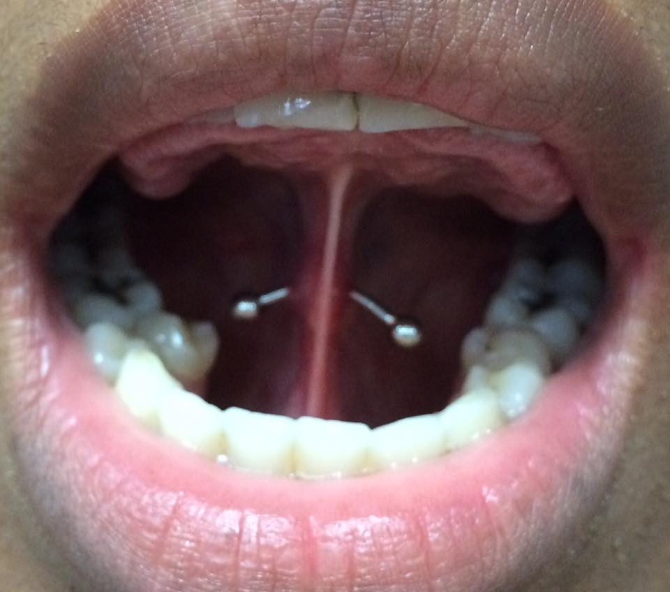 Facebook Page 18 | im thinking of piercing my own tongue web (the thing under your tongue). facebook