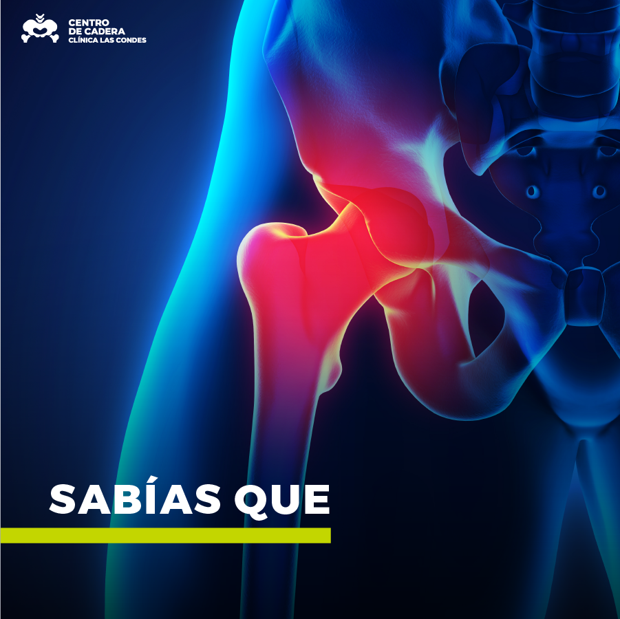 El labrum es el anillo del... - Centro de Cadera CLC