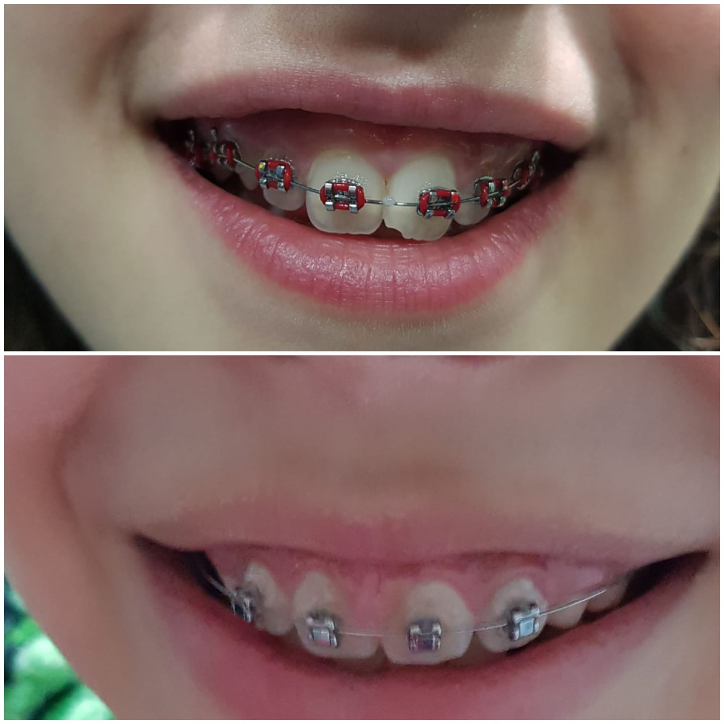 La nueva generación,... - Clínica Dental DRA Fernández
