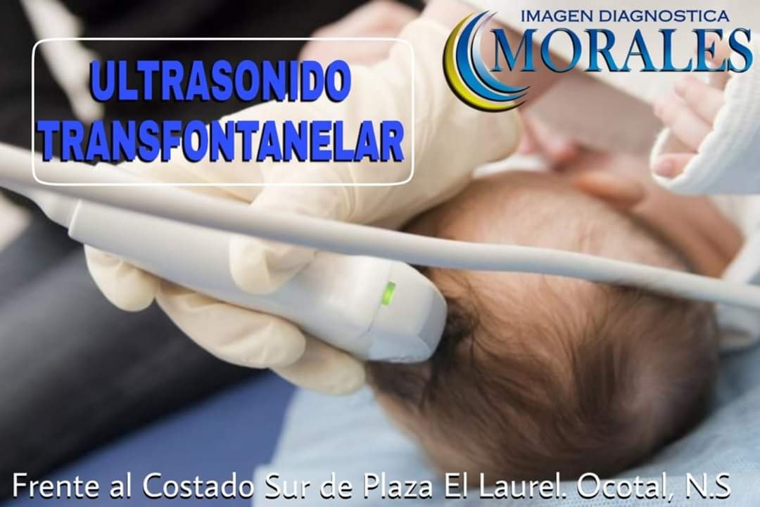 imagen-diagn-stica-morales-el-ultrasonido-transfontanelar-estudio