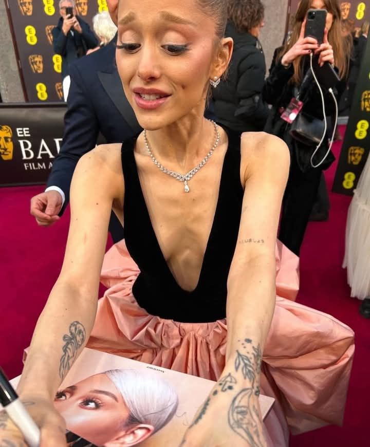 ArianaGrande Can't Escape The 'Ozempic Face' Label After Weight Loss