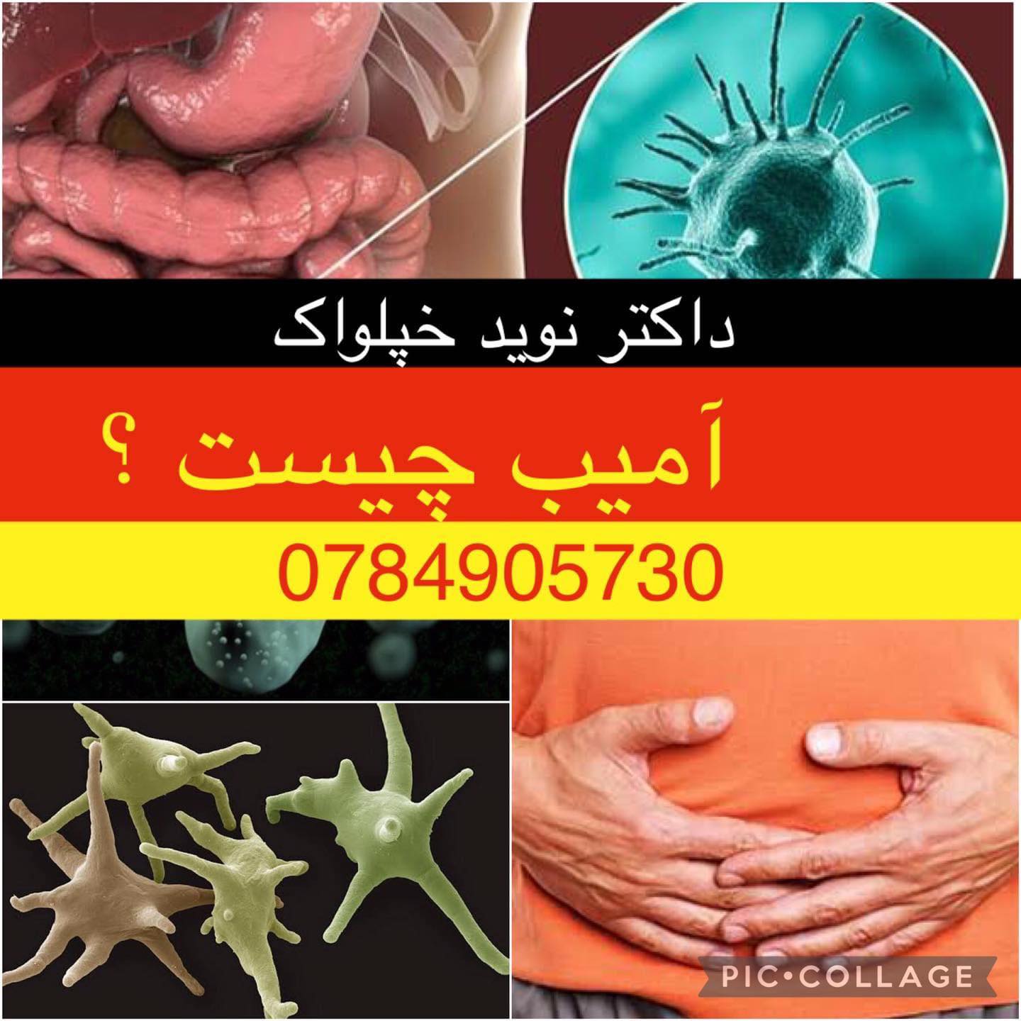 ‎آمیب چیست؟ ‎باعث چه نوع بیماری... - Dr Naweed Khpulwak | Facebook