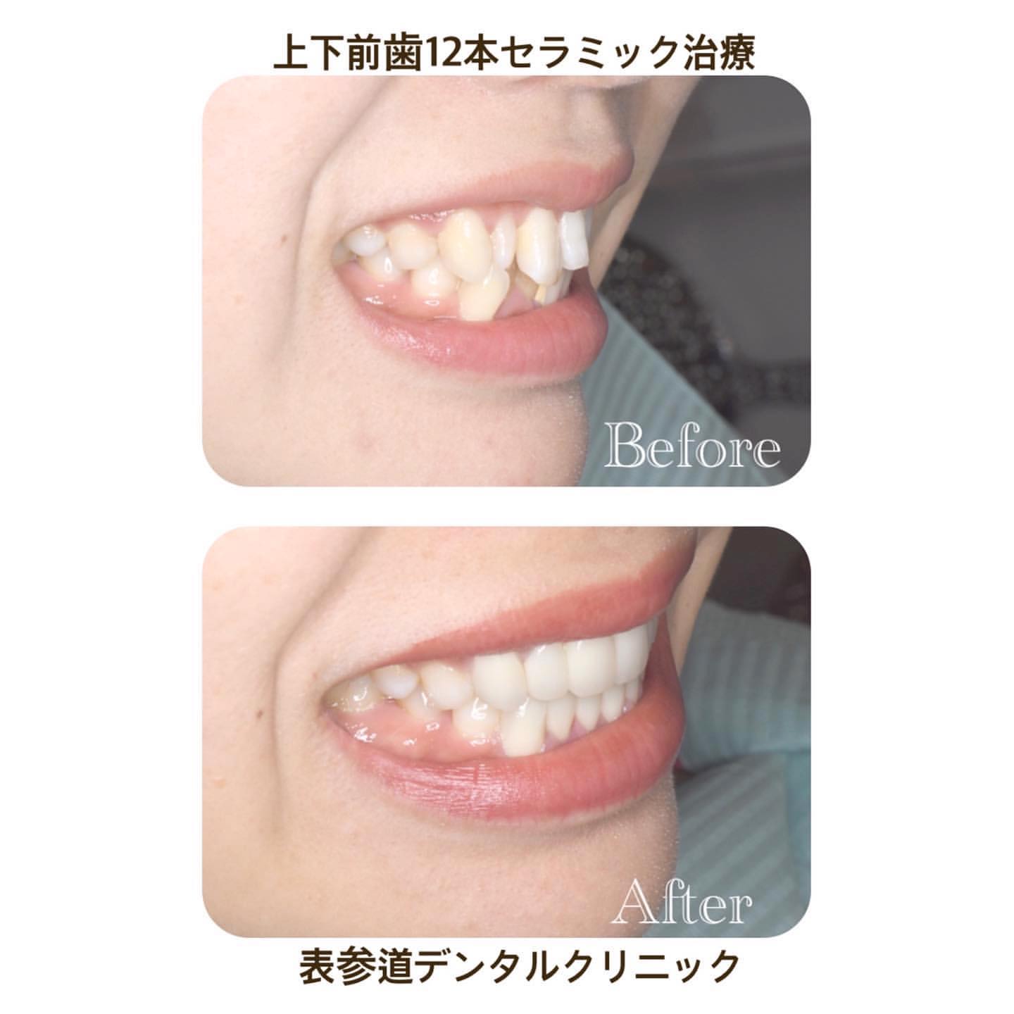表参道 デンタル クリニック