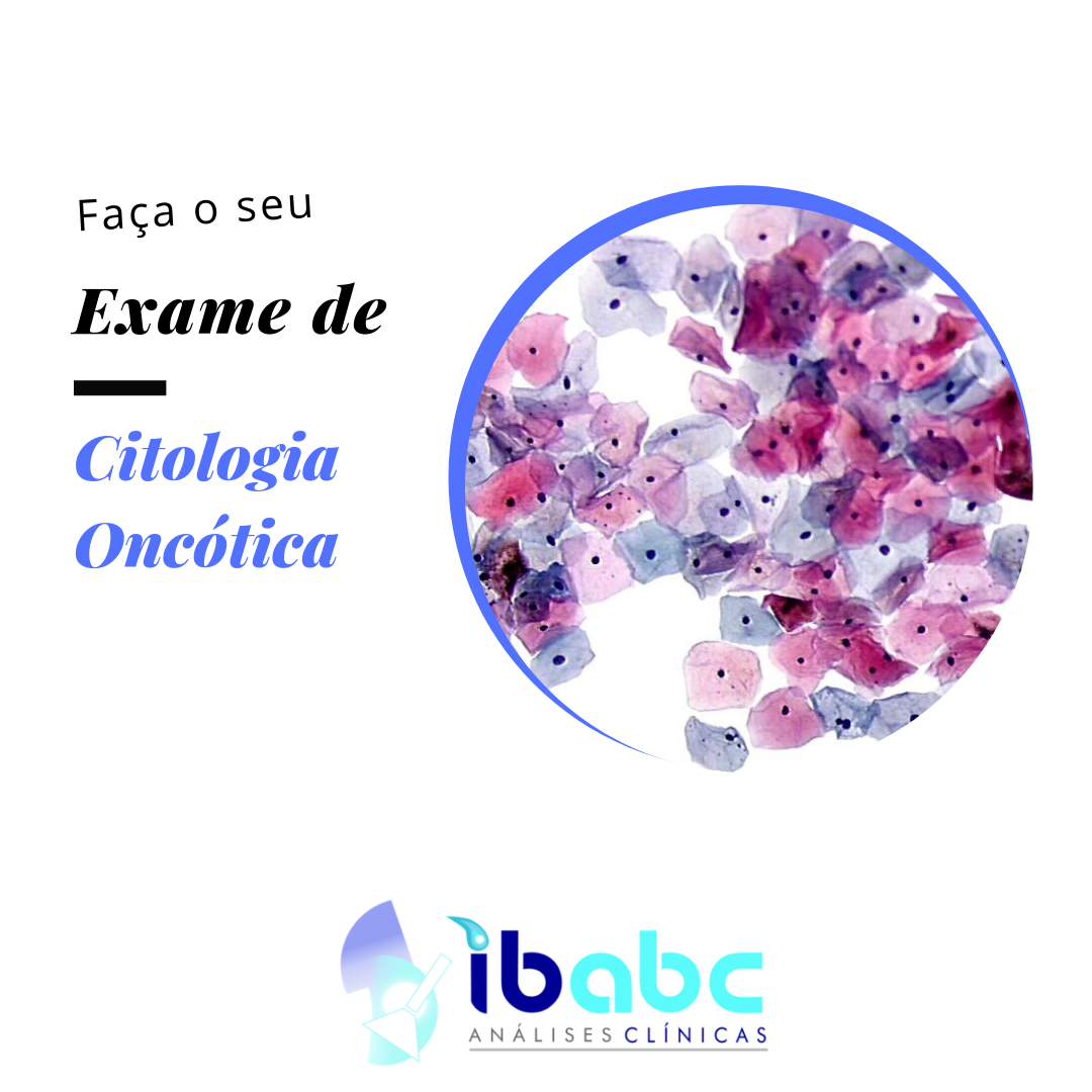 IBABC - Instituto de Biomedicina - O exame de citologia oncótica ...