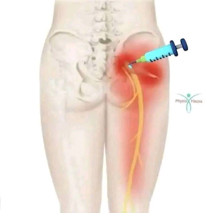 Risks of Wrong Intramuscular Injections and Prevention Measures