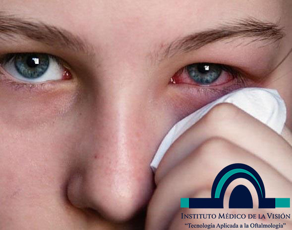 Cuáles son los síntomas... - Instituto Médico De La Visión