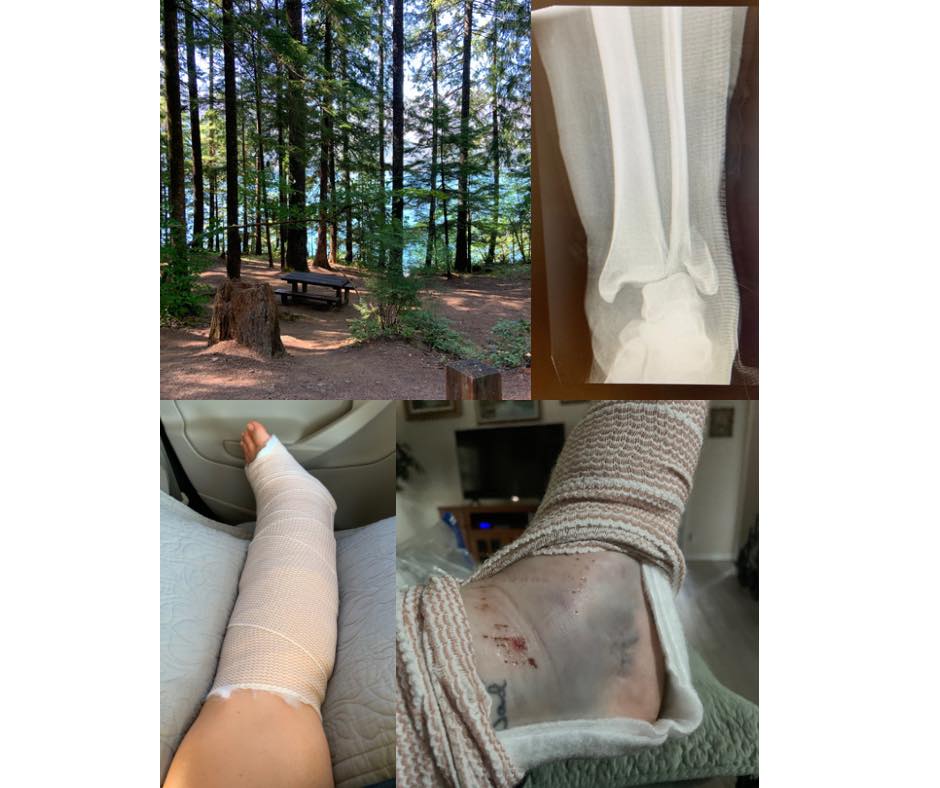 Central Coast Resource Guide - The bad news is: I broke my left leg (7/ ...