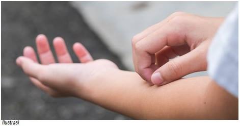 Galeri Healthy And Beauty 6 Kemungkinan Penyebab Kulit Tiba Tiba Gatal Dari Alergi Sampai Leukemia Kulit Yang Terasa Gatal Memang Sangat Tidak Nyaman Apalagi Kalau Datangnya Tiba Tiba Dan Tak Kunjung Sembuh Kadang