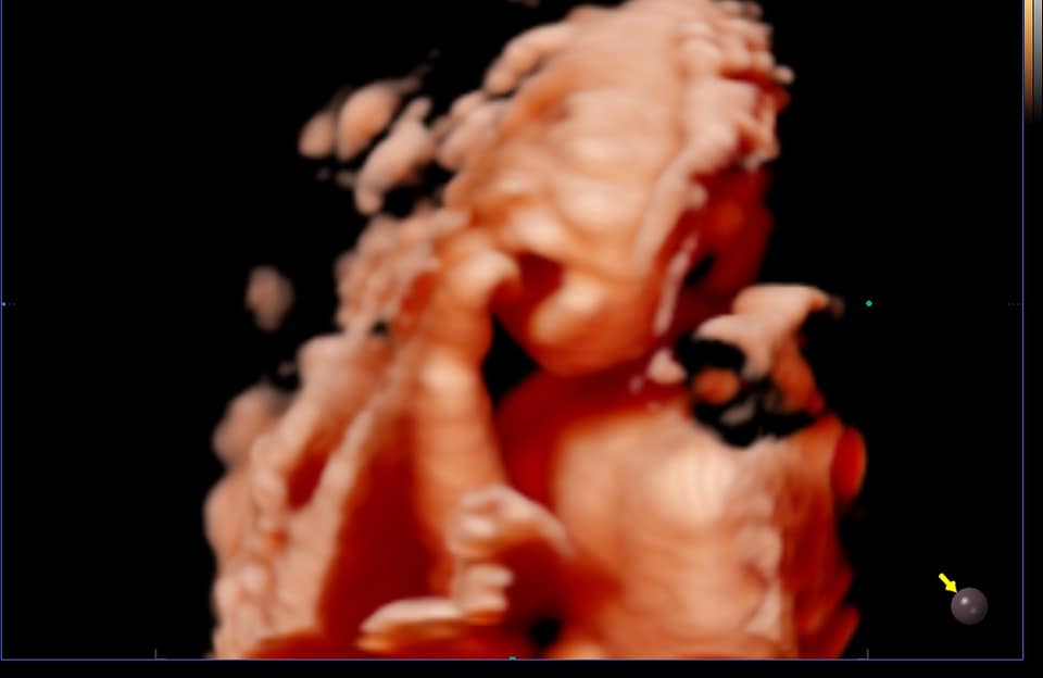 Echographie 3d Bebe Art Echo Facebook