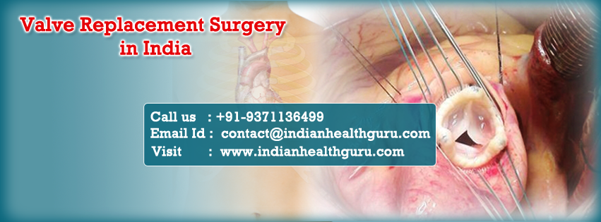 Valve Replacement Surgery in India | Chennai