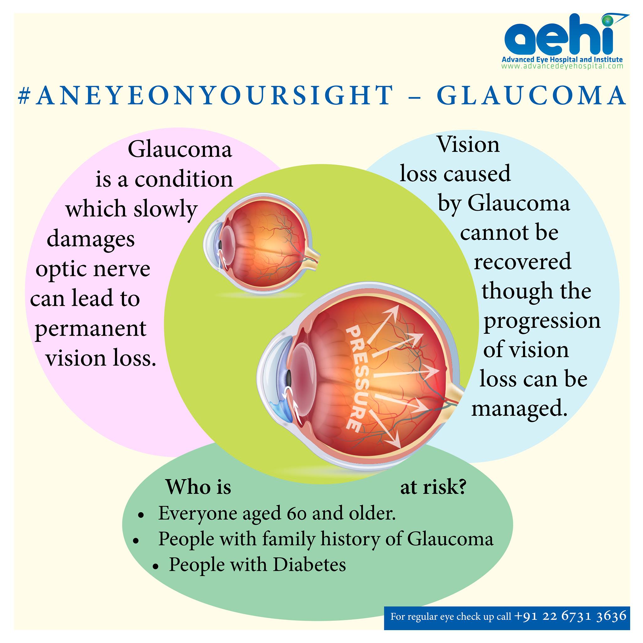 Glaucoma is second leading cause of Blindness globally. It is one of ...