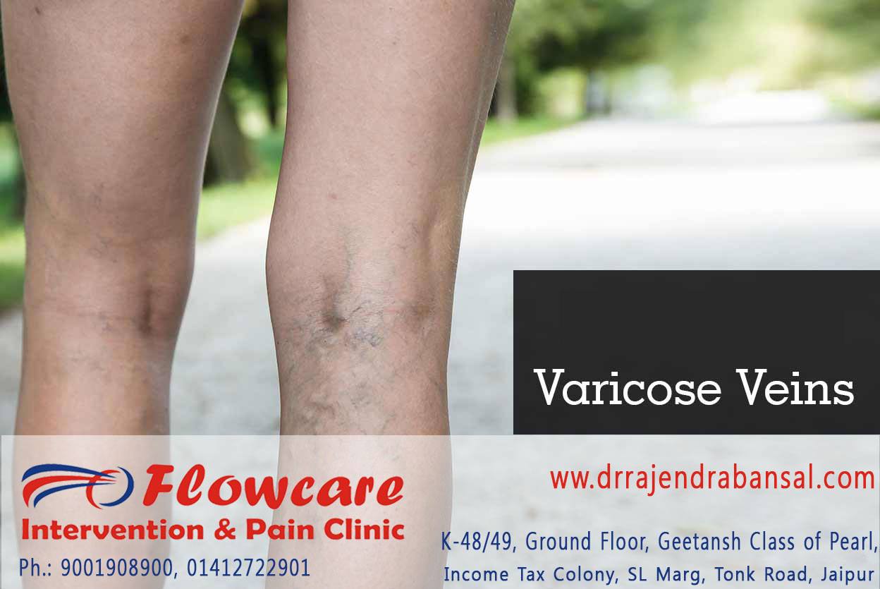 Blood circulation... - Flowcare Diagnostics & Intervention