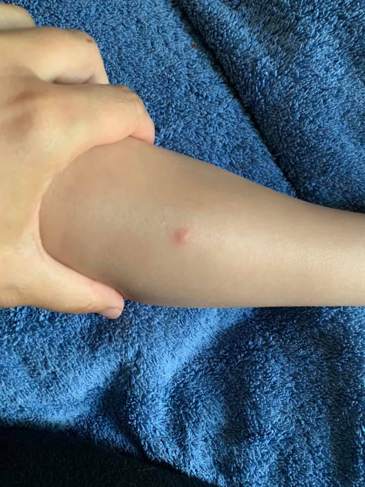 Does this look like a bite mark to yall ? My son isn't a bitter he