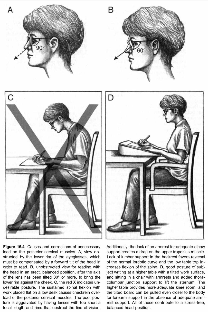 A.M Physio's - Unnecessary Load on Posterior Cervical...