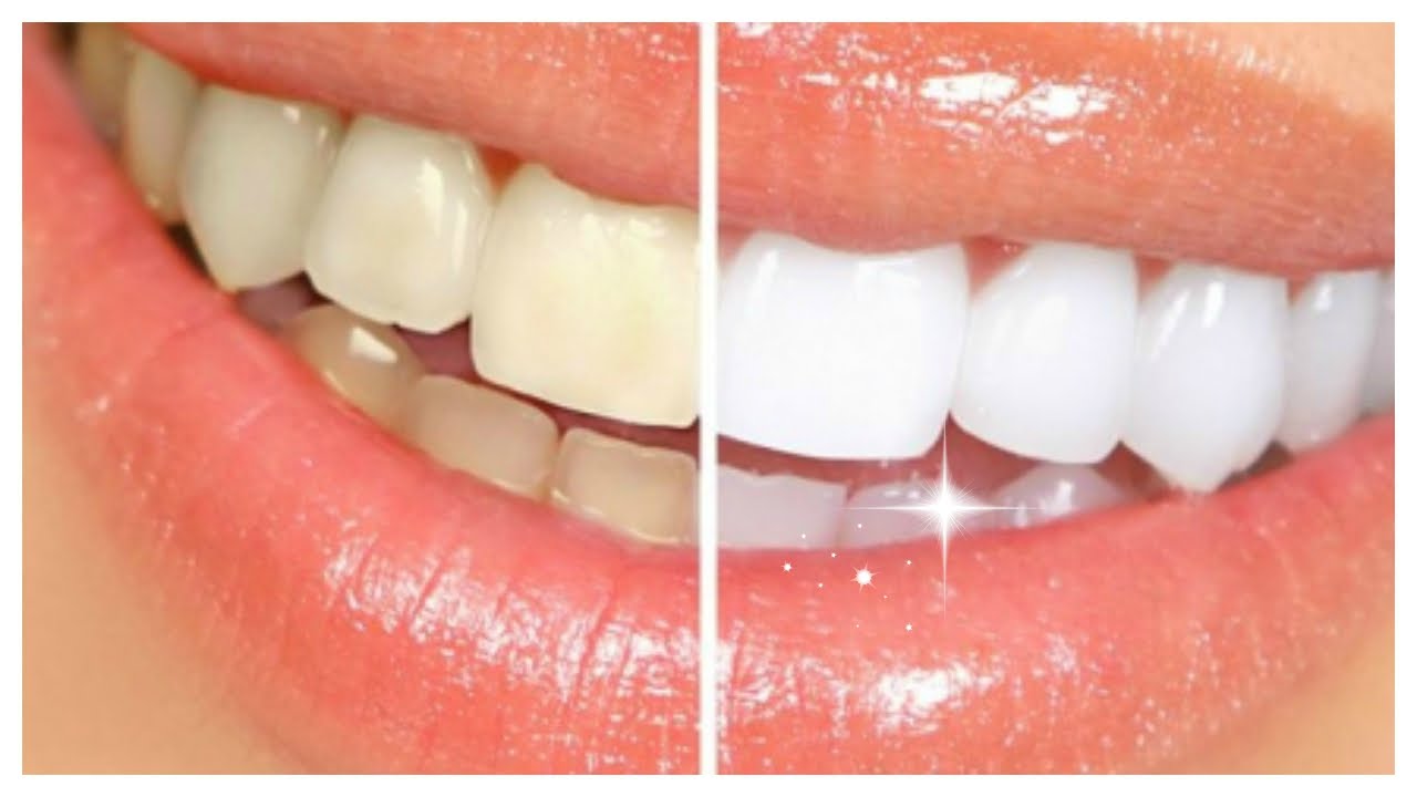 Poppits - Happy National Fresh Breath Day! 😄 Keep your breath smelling ...