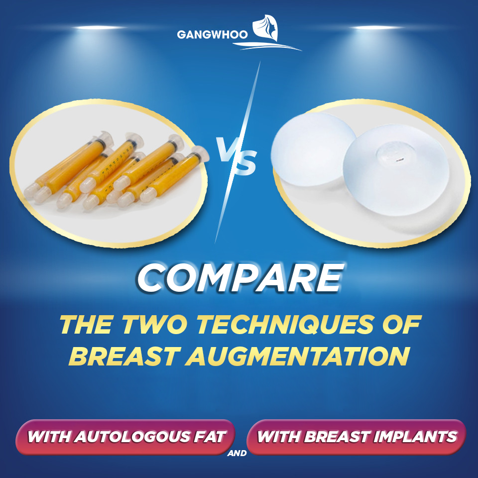 Gangwhoo - WHAT ARE THE DIFFERENCES BETWEEN BREAST...