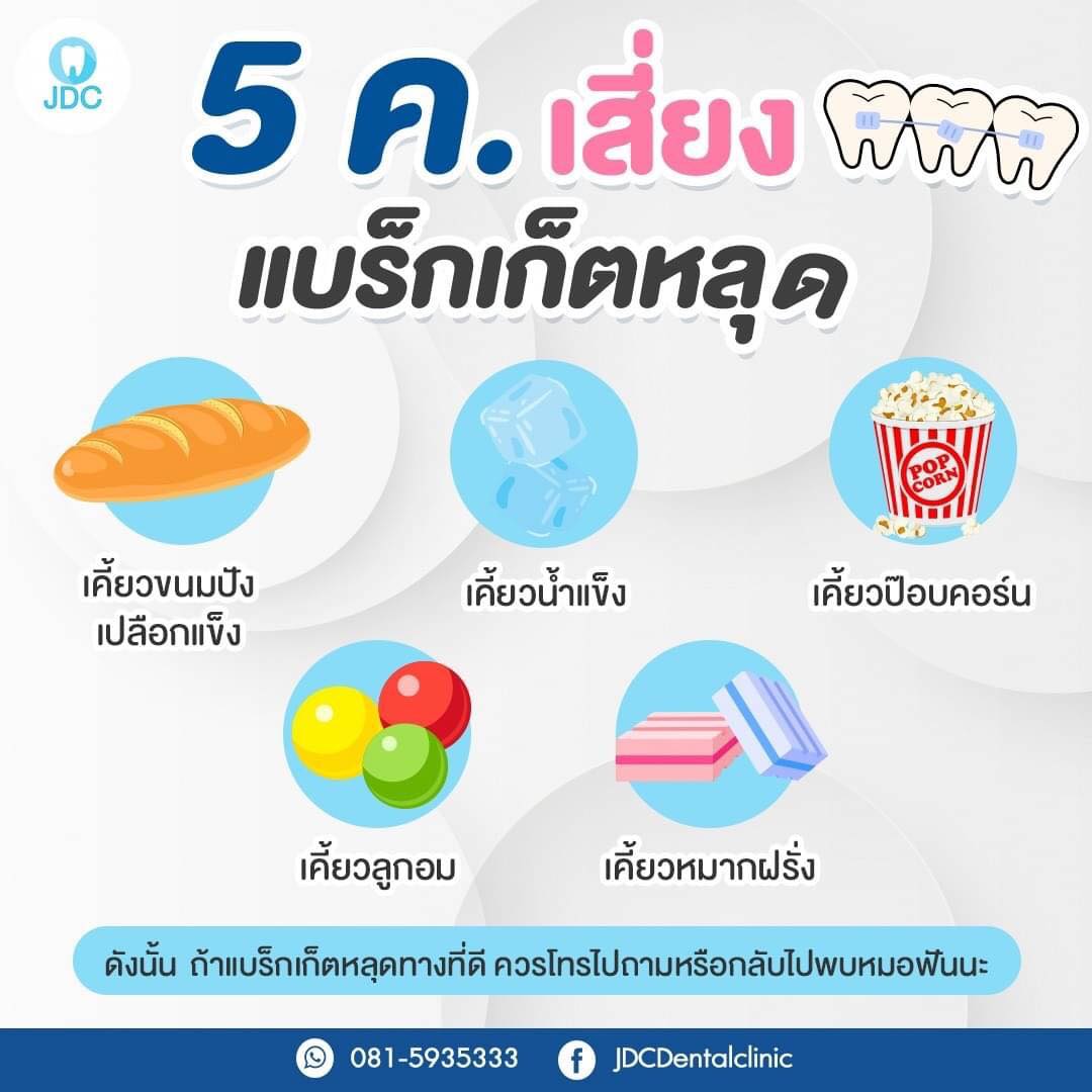 🎯5 ค. เสี่ยงแบร็กเก็ตหลุด😷... - JDC คลินิกทันตแพทย์จอมสุรางค์ | Facebook