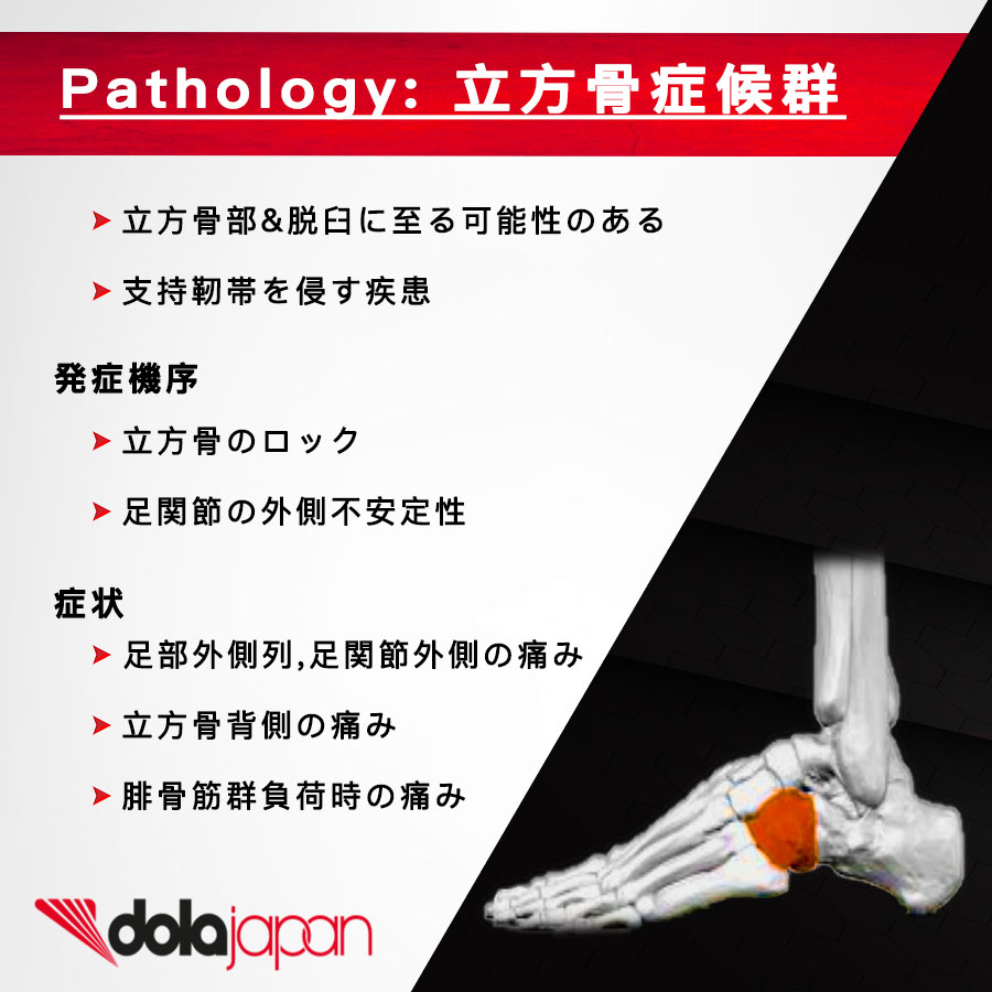 立方 骨 症候群