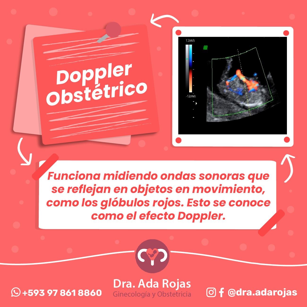 Dra. Ada Rojas - Esta ecografía se realiza vía... | Facebook
