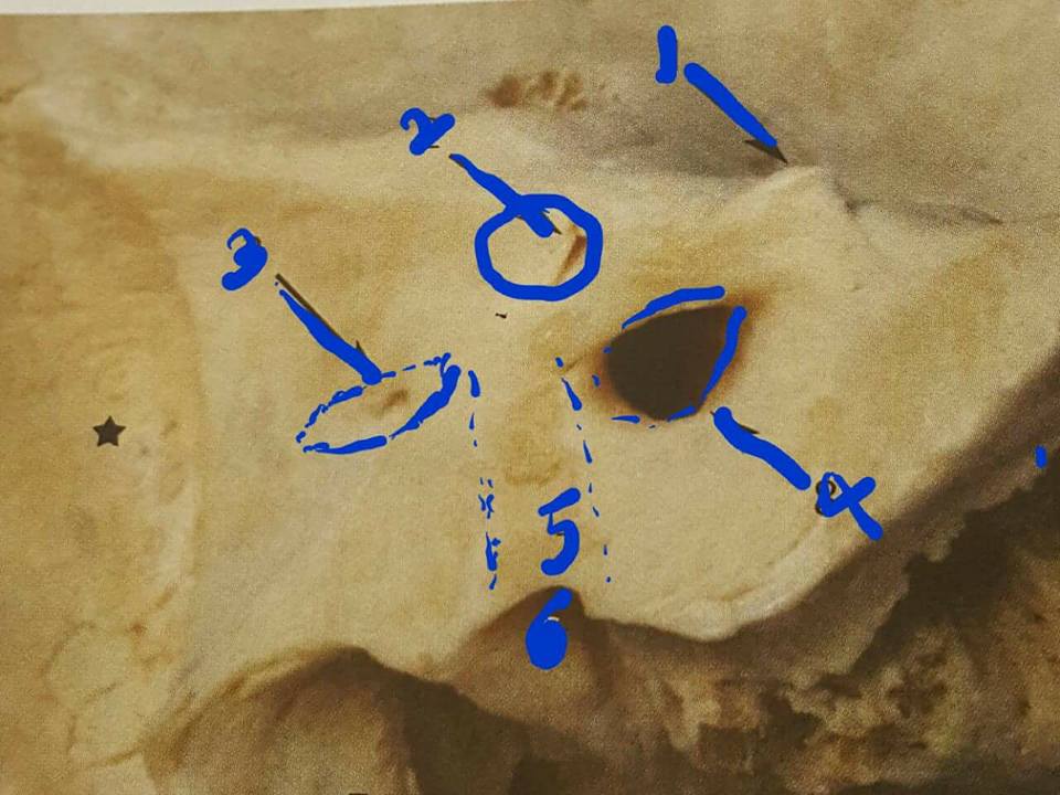 Middle Ear Micro Anatomy by Dr Devan P P