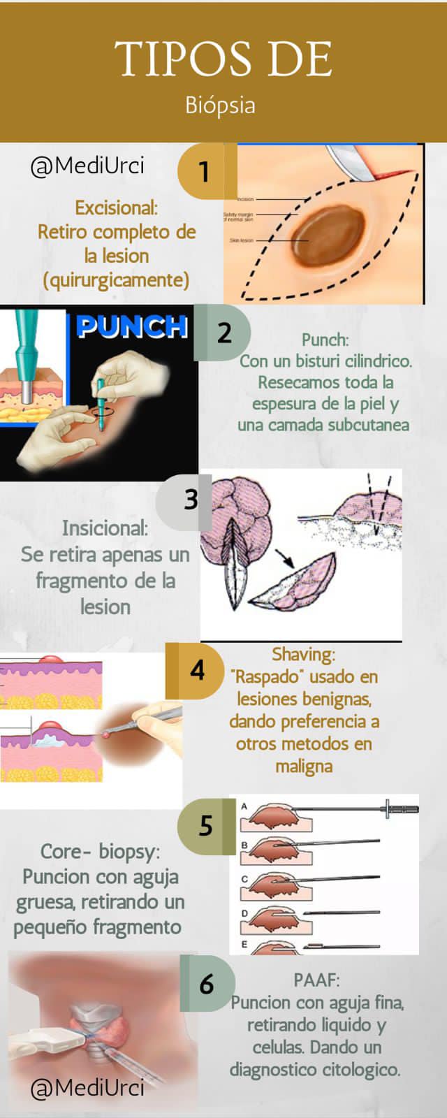 Cirugía 360. - ⚫️ Que es una biopsia? - Es la extracción...