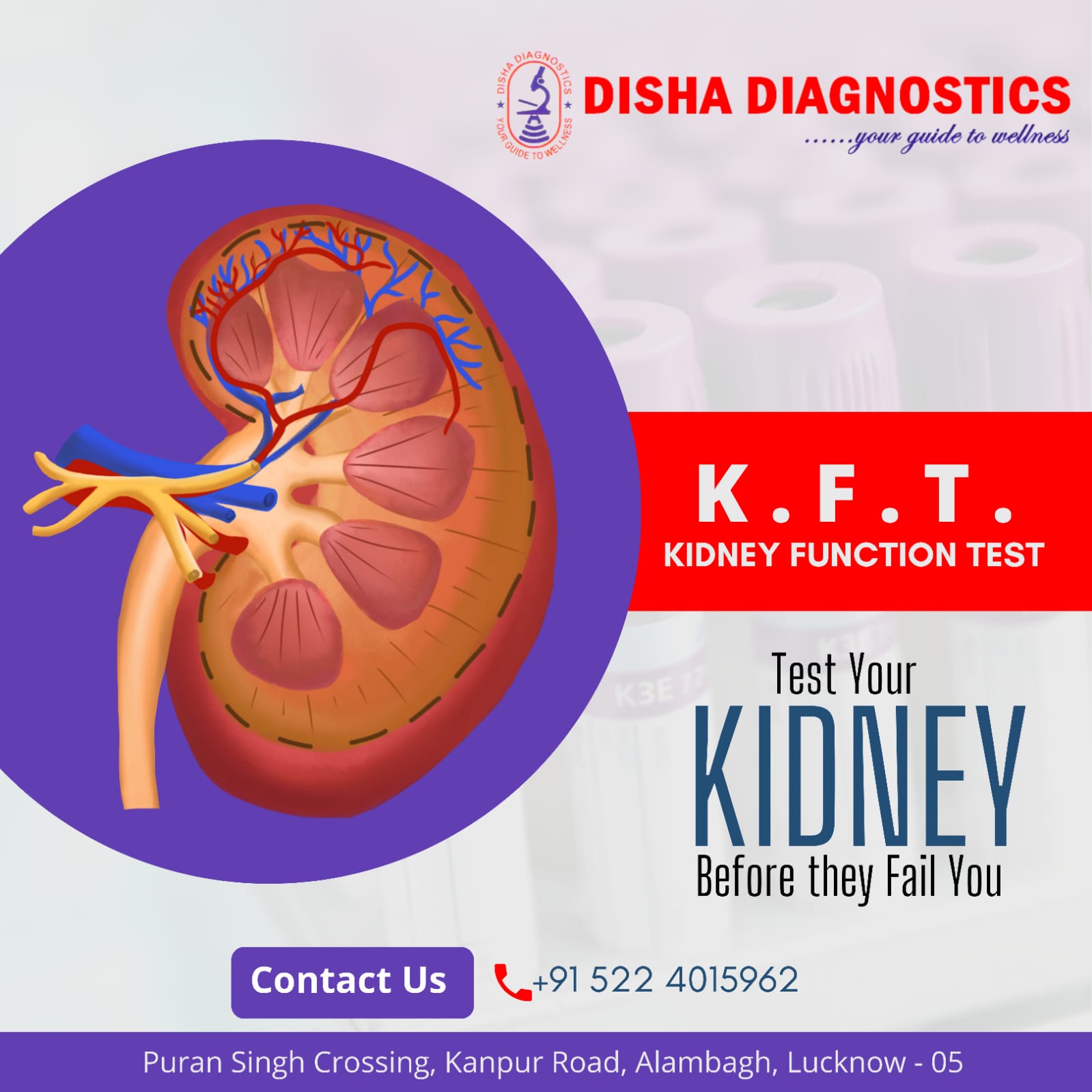 Disha - 𝐊𝐢𝐝𝐧𝐞𝐲 𝐅𝐮𝐧𝐜𝐭𝐢𝐨𝐧 𝐓𝐞𝐬𝐭 (𝐊𝐅𝐓) 𝐈𝐧𝐜𝐥𝐮𝐝𝐞𝐬 𝐚 𝐠𝐫𝐨𝐮𝐩 𝐨𝐟 𝐛𝐥𝐨𝐨𝐝 𝐭𝐞𝐬𝐭 ...