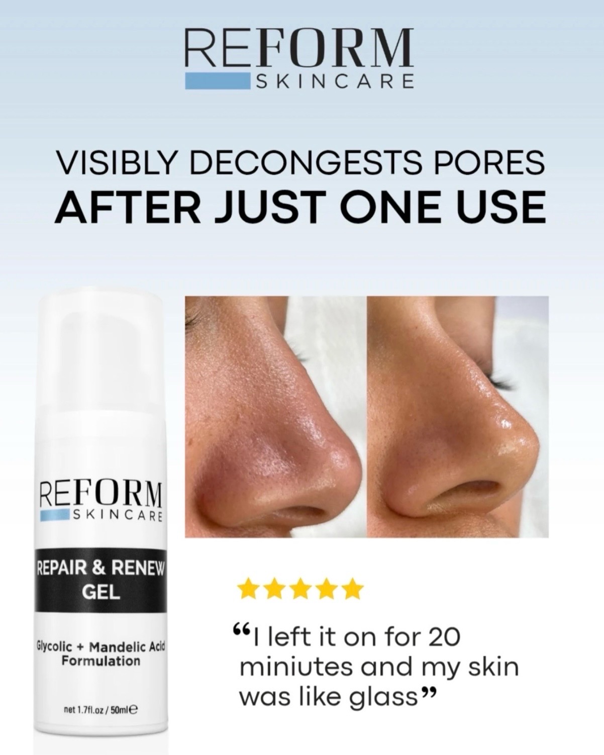 Skin - As it