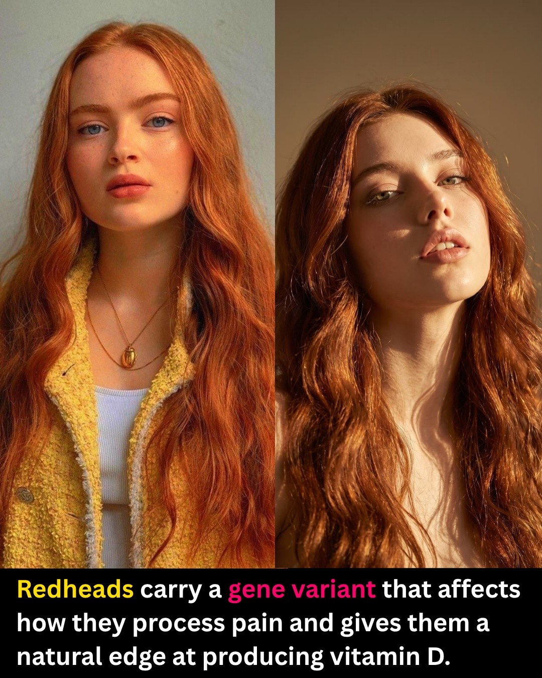 melanotan redhead Redheads make up roughly two percent of the global population, and the trait comes from mutations in the MC1R gene on chromosome 16. This single gene explains a surprising number of physical Marty Ross MD: books,